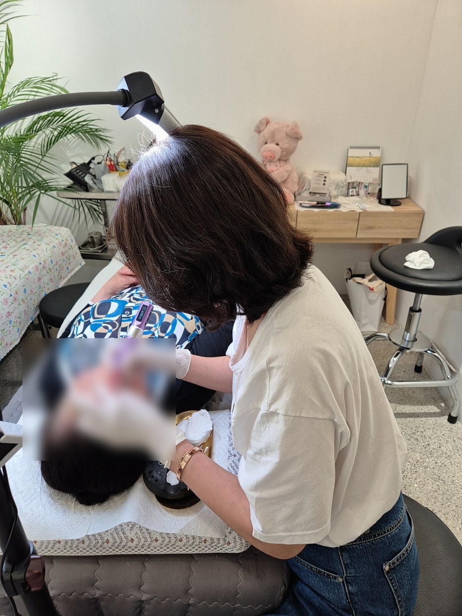 소예뷰티 실제 시술