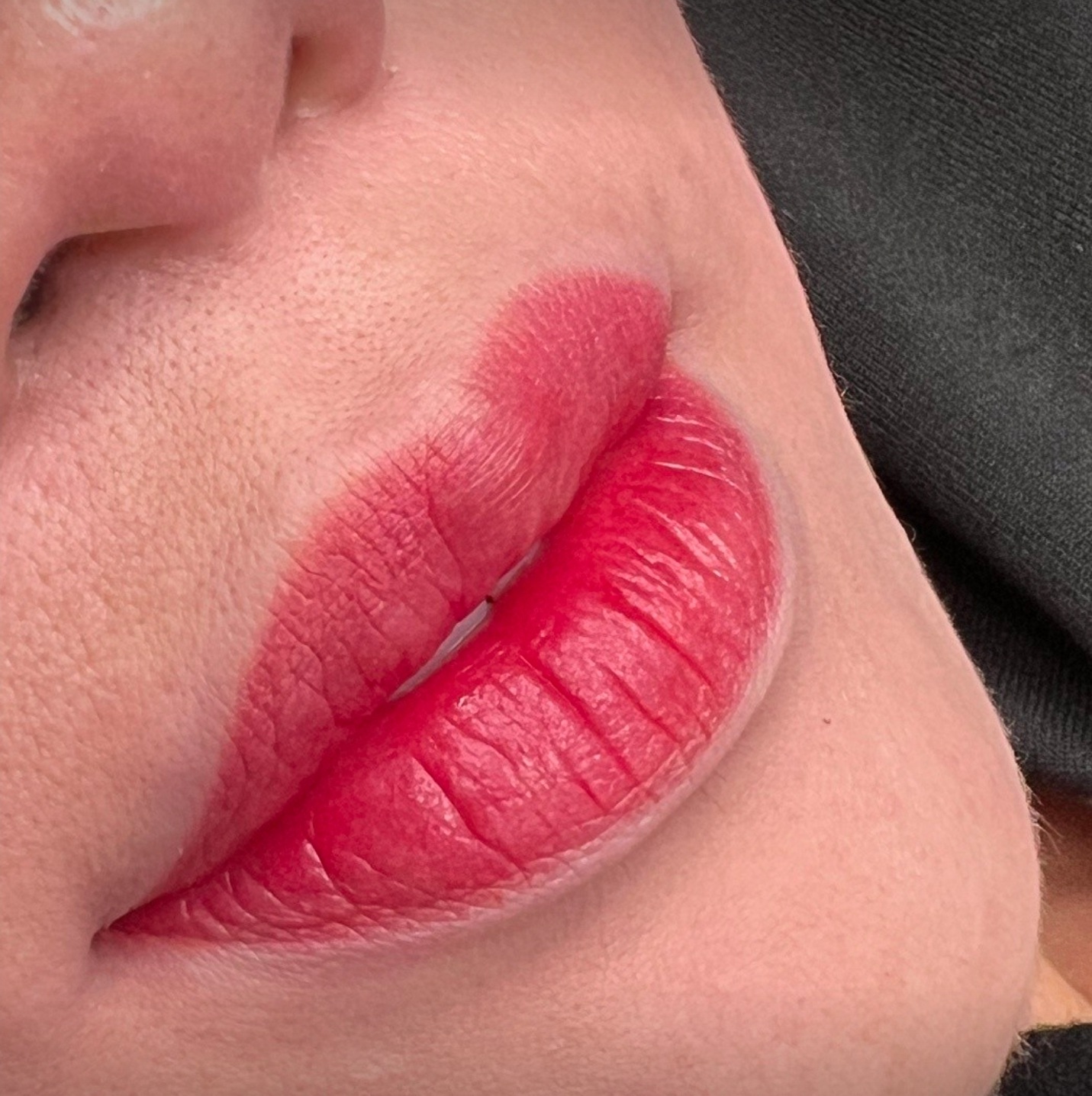 입술 반영구 시술