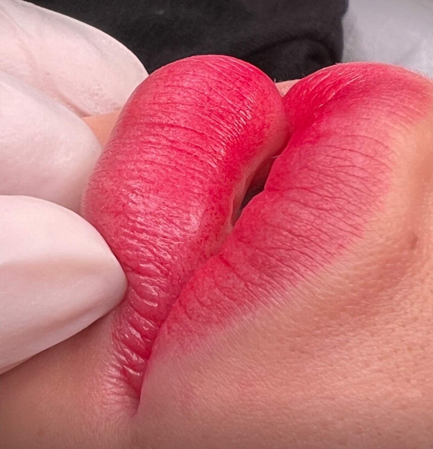 입술 반영구 시술