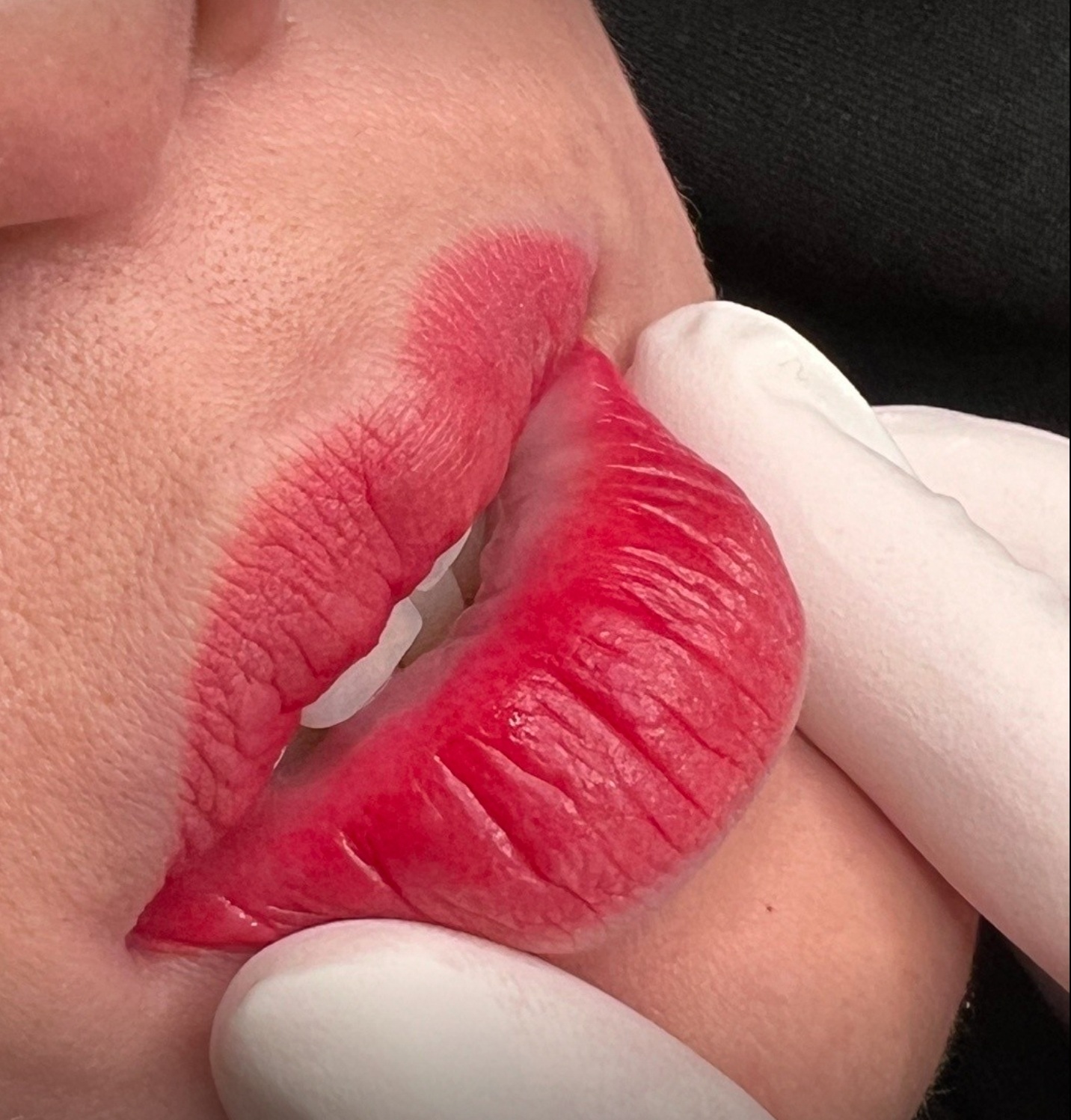 입술 반영구 시술